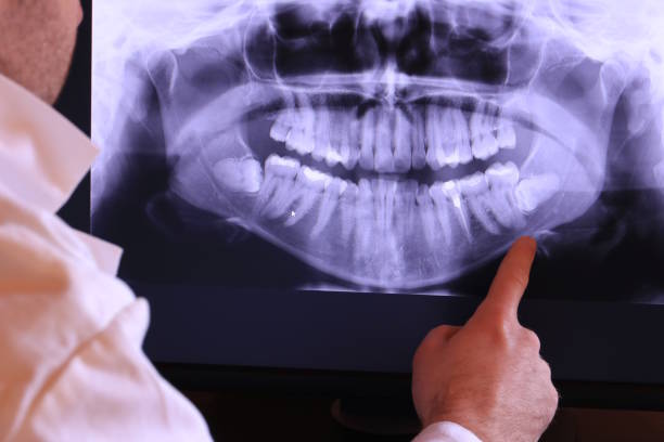 Best Emergency Dental Care for Broken or Chipped Teeth in Arcola, VA