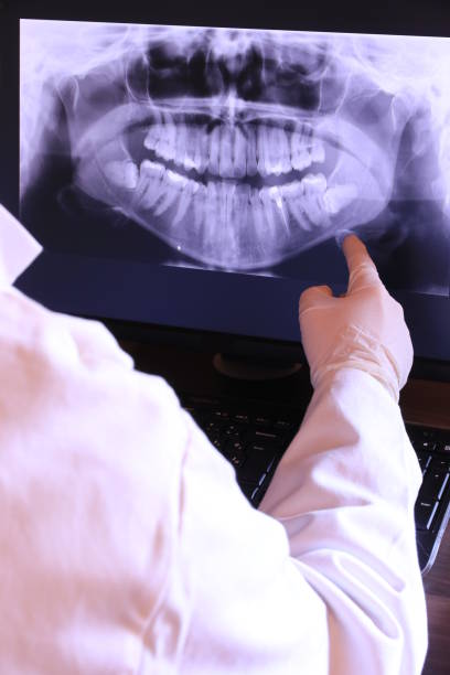 Best Emergency Tooth Extraction in Arcola, VA